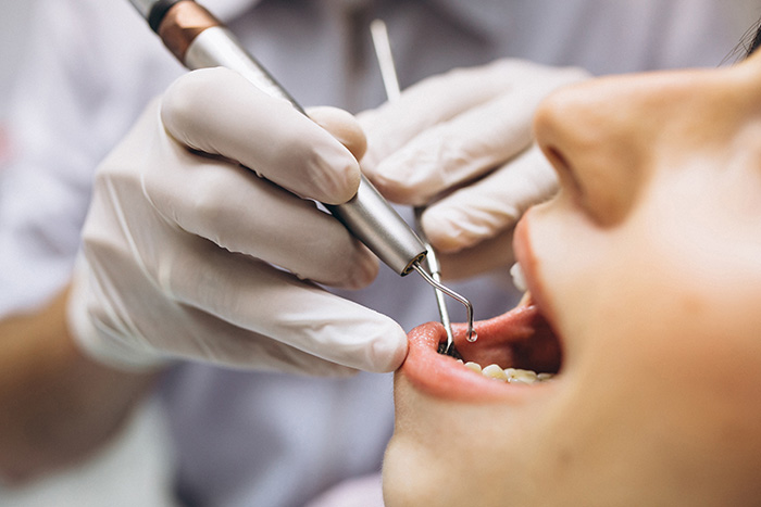 Tratamiento de endodoncia