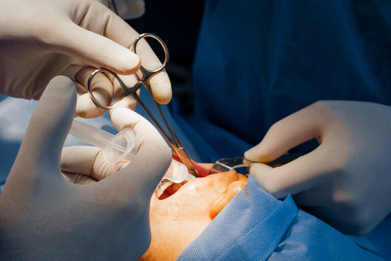 Cirugía oral e implantes dentales